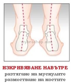 Шпора или подложка за корекция на петата за правилно стъпването при кривене на краката на наляво и надясно.
